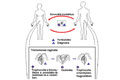 Trichomoniasis