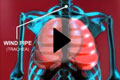 Asthma bronchiale