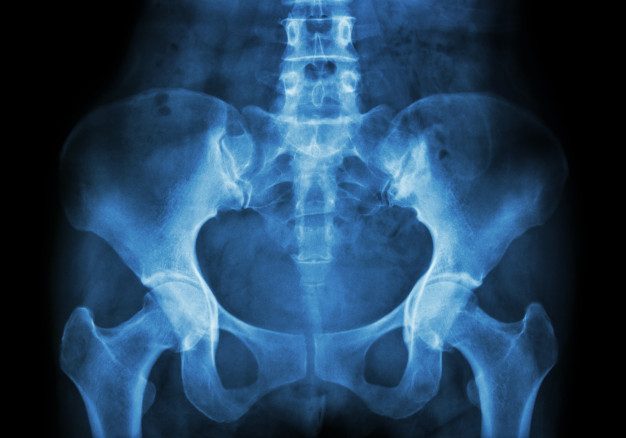 a csípőízület artrózisának radiológiai jelei jobb oldali fájdalom hátul