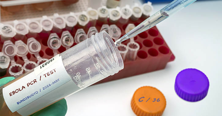 Ebola