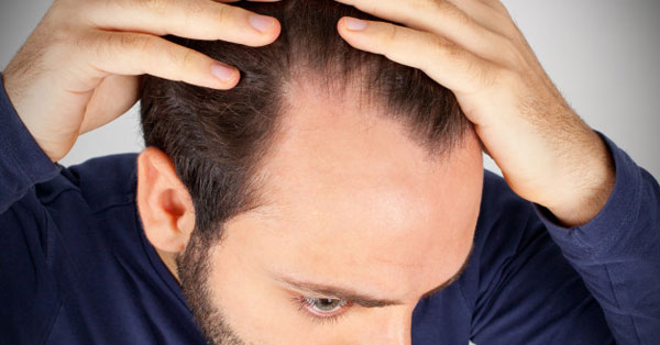 A hajhullás 5 oka - ilyen betegségek állhatnak a hátterében! - EgészségKalauz