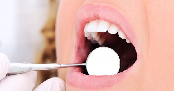 a szájnyálkahártya pikkelysömörének kezelése