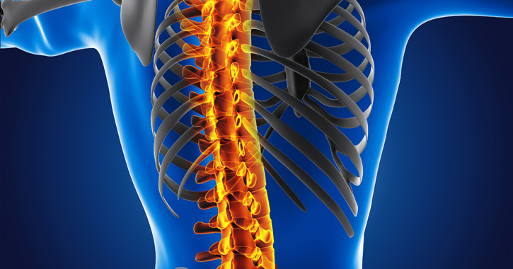 Spondylosis