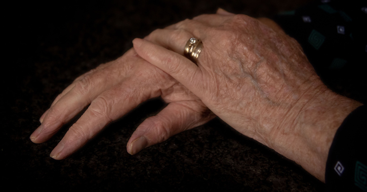 A rheumatoid arthritis kezelése