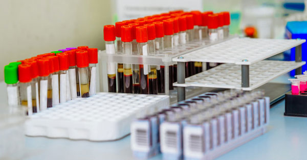 inzulinrezisztencia laborértékek diabetes tibet kezelése