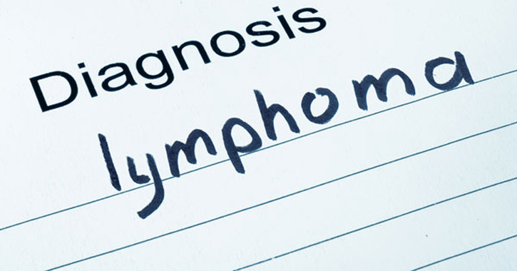 A limfómák főbb típusai, okai és tünetei