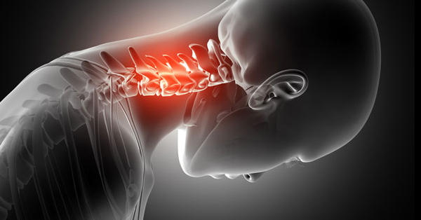 Nyaki gerinc fájdalom és csillapítása - Budai FájdalomKözpont