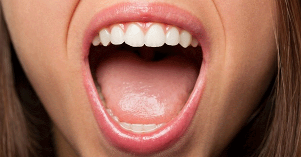 nyelv vörös foltokban egy felnőtt kezelés során