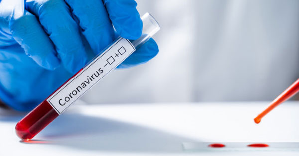 SARS-CoV-2 PCR EASY - Önmintavételes teszt