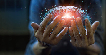 Az Alzheimer-kór kockázatát növelő tényezők