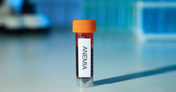 Már a vérszegénység kialakulása előtt jelentkeznek a vashiány tünetei