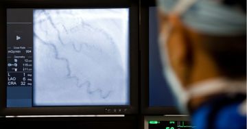 Kivizsgálás érelmeszesedés esetén - Angiográfiával felismerhetőek a szövődmények