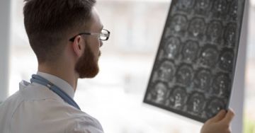 Aorta aneurizma - Időzített bomba a testben