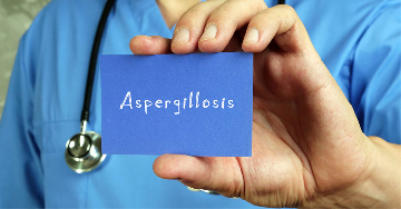Aspergillosis (Aspergillus gomba okozta fertőzés)
