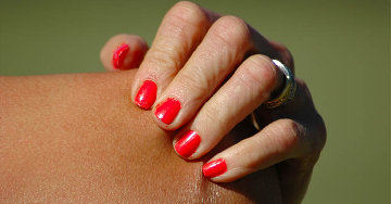 Tanorexia - A kényszeres barnulás