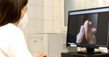 Mesterséges intelligencia segíti a bőrbetegségek felismerését