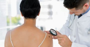 Rákelőző állapot a bőrön: a Paget-kór