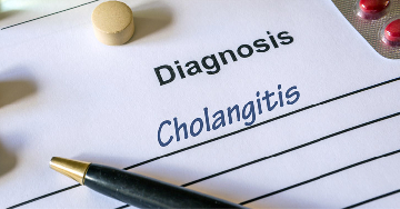 Epeúti gyulladás (cholangitis)