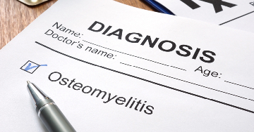 Csontvelőgyulladás - Típusok, okok, tünetek és kezelés