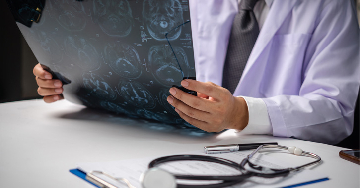 Sugárterheléssel járó vizsgálatok - Kell-e félnünk az orvosi diagnosztikától?
