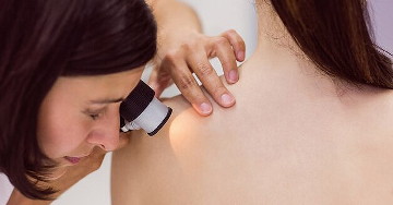 Dermatoszkóp - Dermatoszkópos vizsgálat