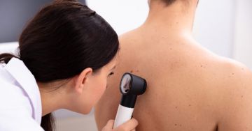 A melanoma tünetei és felismerése