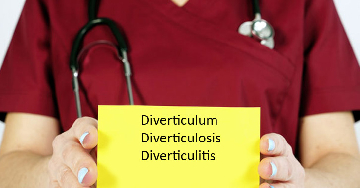A vastagbél-diverticulosis és -diverticulitis