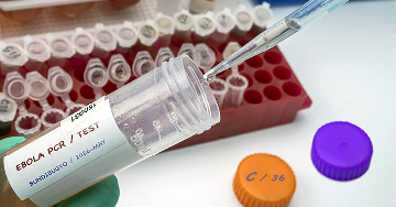 Mit kell tudni az Ebola-vírusról?