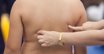 A gyermekkori elhízás a tévhitek tükrében