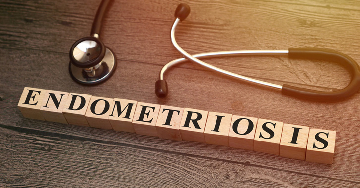 Az endometriózis növeli a stroke kockázatát