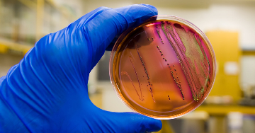 Az Escherichia coli (E. coli) baktérium
