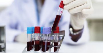 Fiatalkorban is ellenőrizni kellene a koleszterinszintet