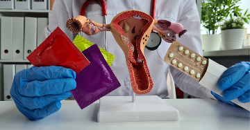 Fogamzásgátlási módszerek összehasonlítása