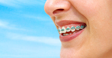 A fogszabályozás hatása a fasciarendszerre és az állkapocsízületre