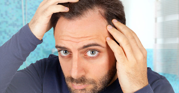 Stressz és hajhullás: Van összefüggés?