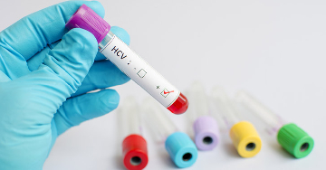 Másodszor is megfertőződhetek? Gyakori kérdések a hepatitisz C-ről