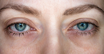 Heerfordt-szindróma