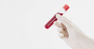 Hematokrit (HTC) - Mit jelez a vérképben?