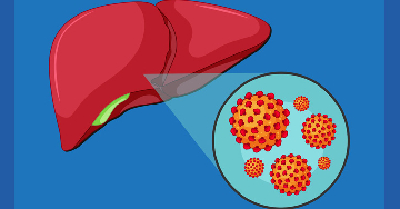A hepatitis E-fertőzés kezelése és megelőzése
