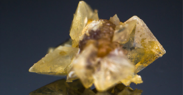 Húgyhólyagkövesség - A hólyagkövek okai, tünetei, kezelésük, megelőzésük