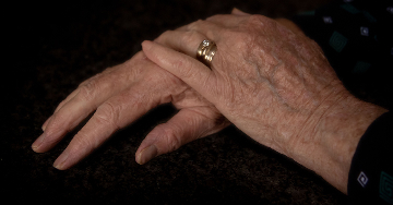A rheumatoid arthritis kezelése