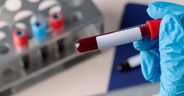 A troponin mint laborérték