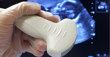 A kései gyermekvállalás kockázatai a baba egészsége szempontjából