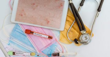 Majomhimlő - Mit kell tudni a hazai helyzetről?