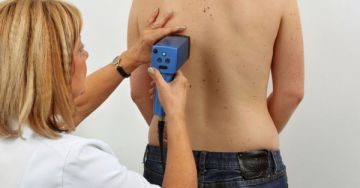 Hogyan alakul ki és hogyan előzhető meg a melanoma?