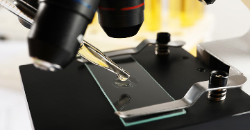 A liquid biopszia