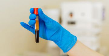 Koleszterin: összkoleszterin, HDL, LDL