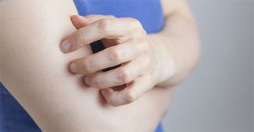 Az ótvar tünetei, szövődményei és kezelési lehetőségei
