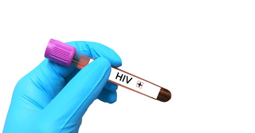 HIV-pozitív - Az első kérdések a diagnózis után