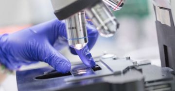 Precíziós onkológia a melanoma kezelésében